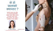 के हो छालाको क्यान्सर, कसरी बच्ने?
